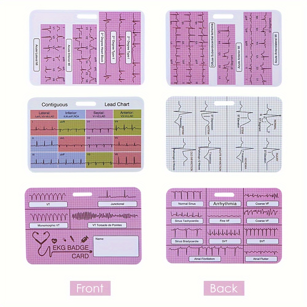 TEMU Aetius Ekg Cardiac Badge Card 3 Card Set, Badge Card Ekg Telemetry Interpretation Badge Buddy, Nurse 12 Lead Ecg Rate Pocket Cards, Nursing Cheat Sheet With Ekg Ruler Measurement, Double Sided