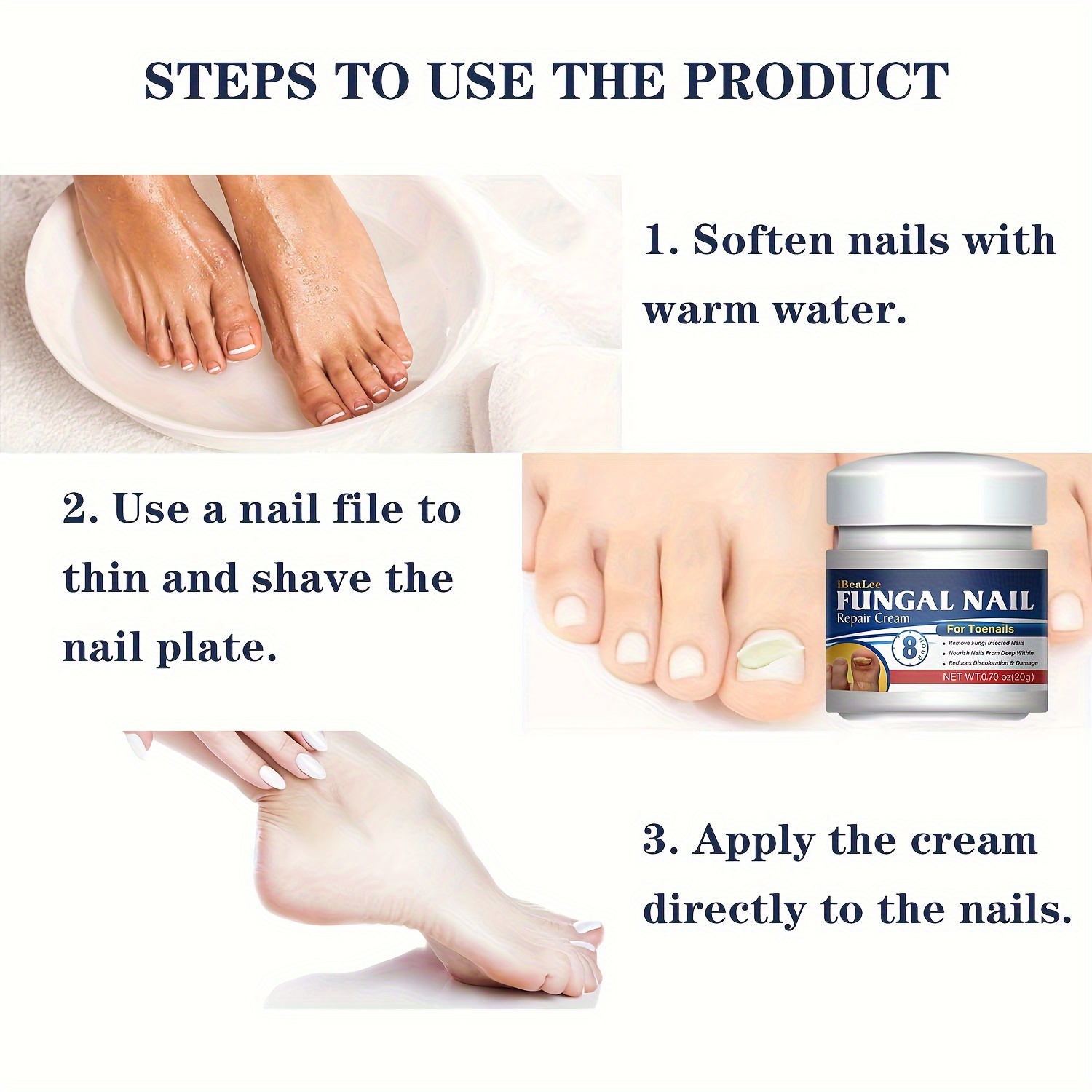 Antifungal Cream For Toenails Nails Soothing Relief From Fungus
