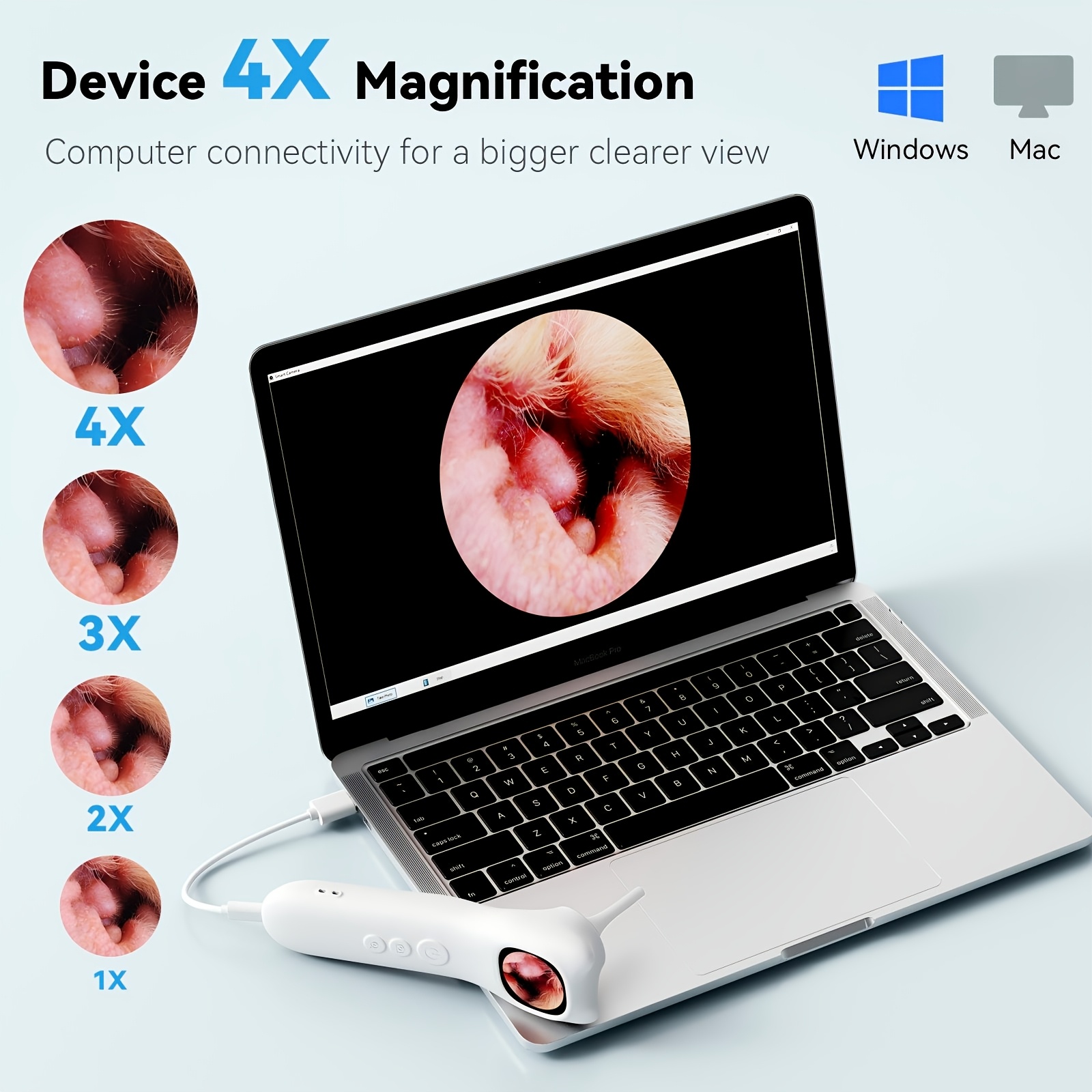 This Home-Use Pet Smart Detector Combines Four Functions in One, Featuring a 1080P High-Definition Ear Endoscope Camera with 4X Zoom for Clear Internal Viewing. It Comes with 12 Specialized Examination Heads to Fit Different Body Parts - Image 8