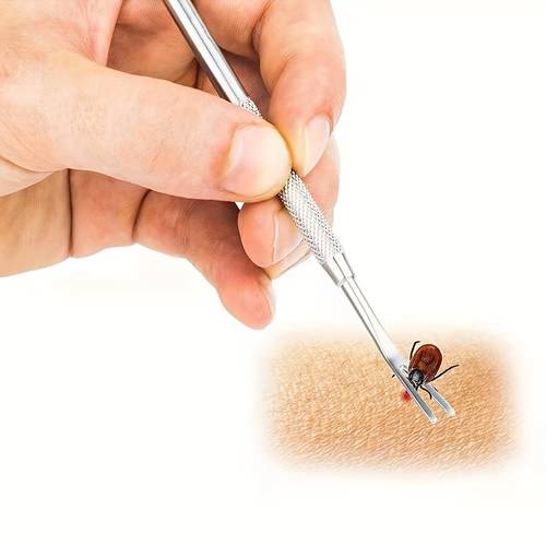 2pcs set of stainless steel pet insect repellent tools for cats and dogs flea clips lice removers tick clips flea tweezers transparent boxes fleas and lice professional pet cleaning tools pet household product