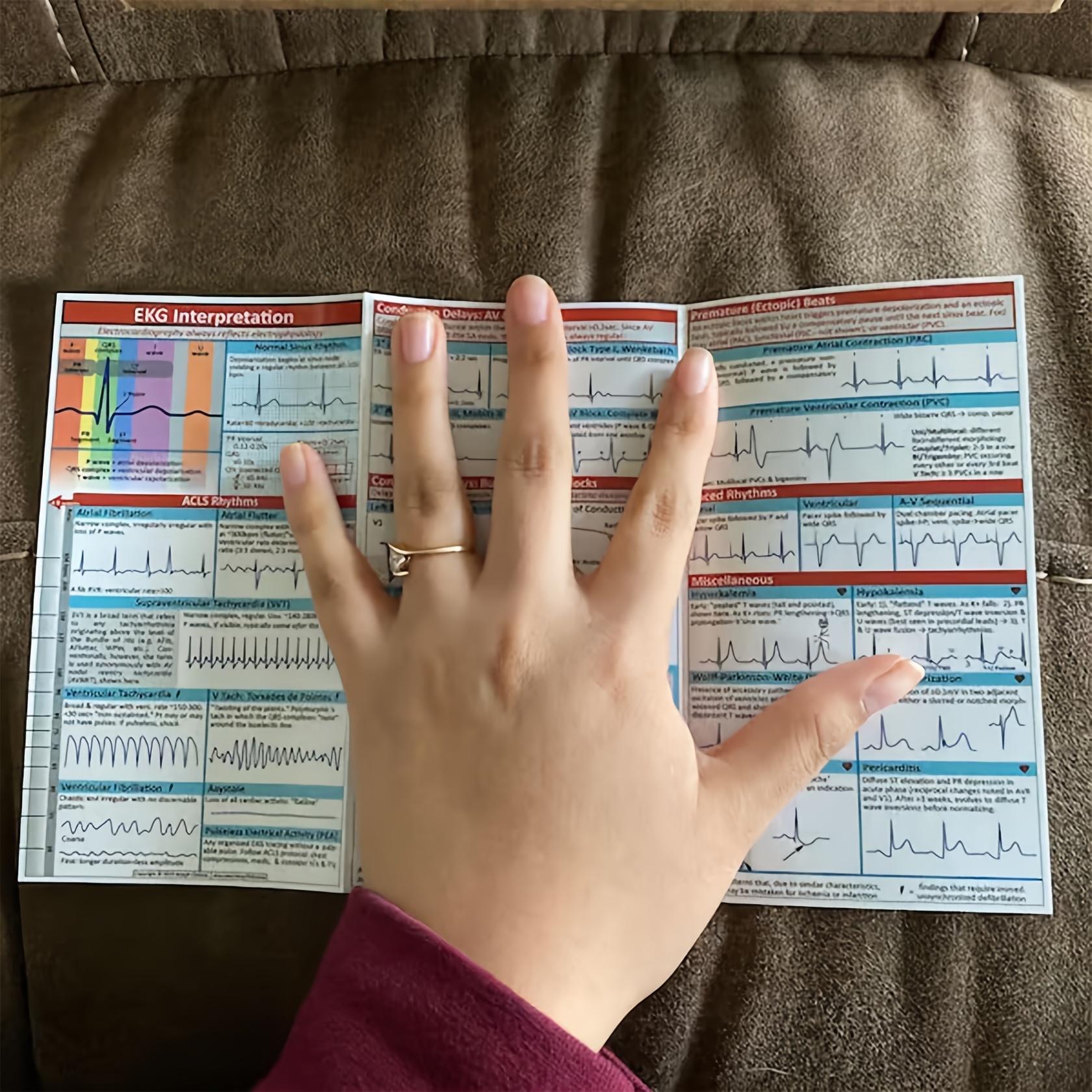 EKG Pocket Guide: Quick Reference For EKG Interpretation (ebook), Cathy