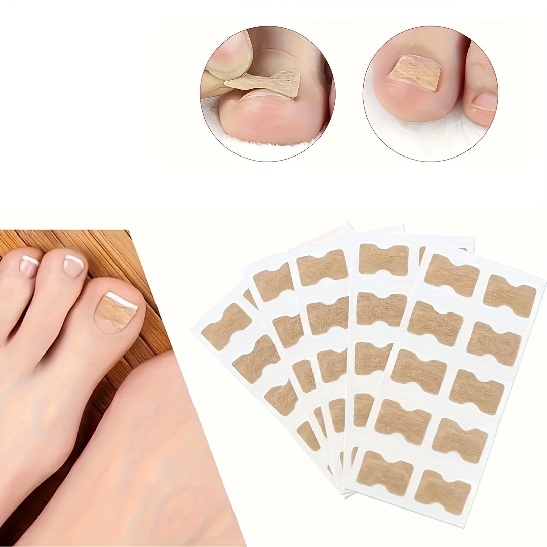 100pcs Ingrown Toenails Corrector Nail Pads Toenail Patches Glue Free