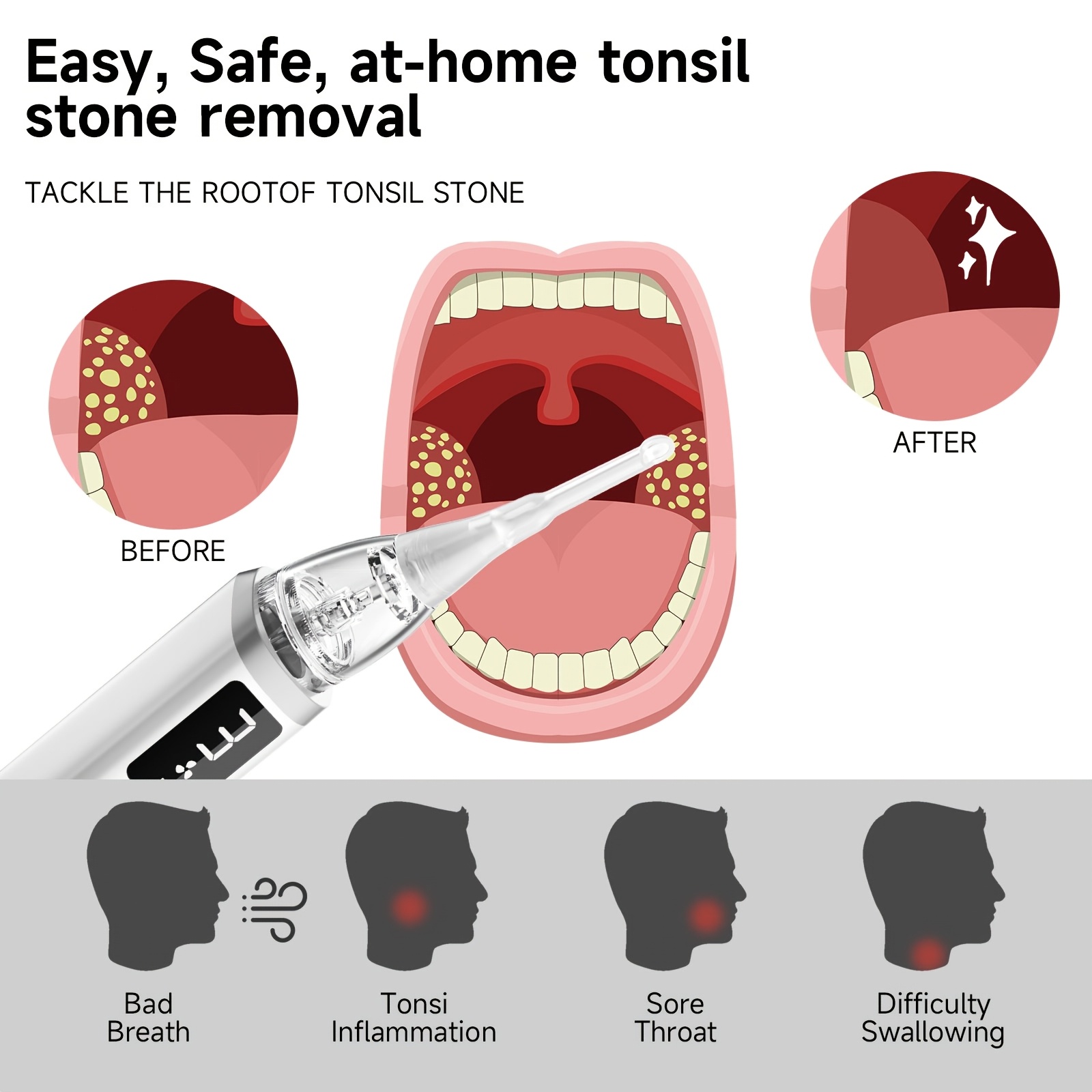 TEMU Usb Rechargeable Tonsil Stone Removal Kit With Led Light - 8 Suction , Oral Irrigator & Tongue Scraper For