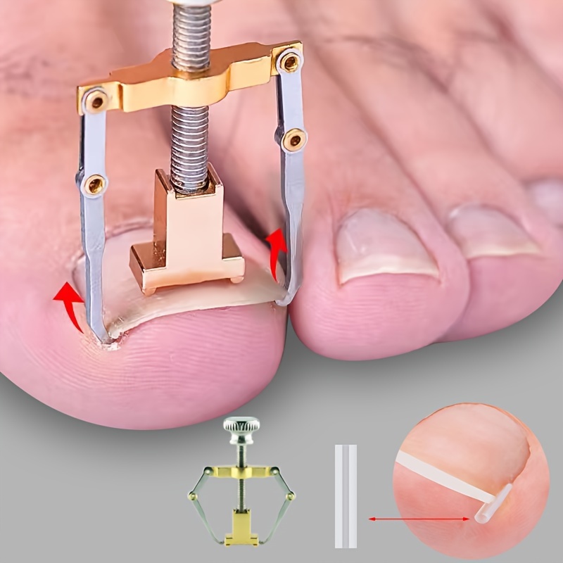 

Ingrown Toenail Correction Tool - Softens & Easily Trims, Pedicure Nail Recovery Patch, Odorless