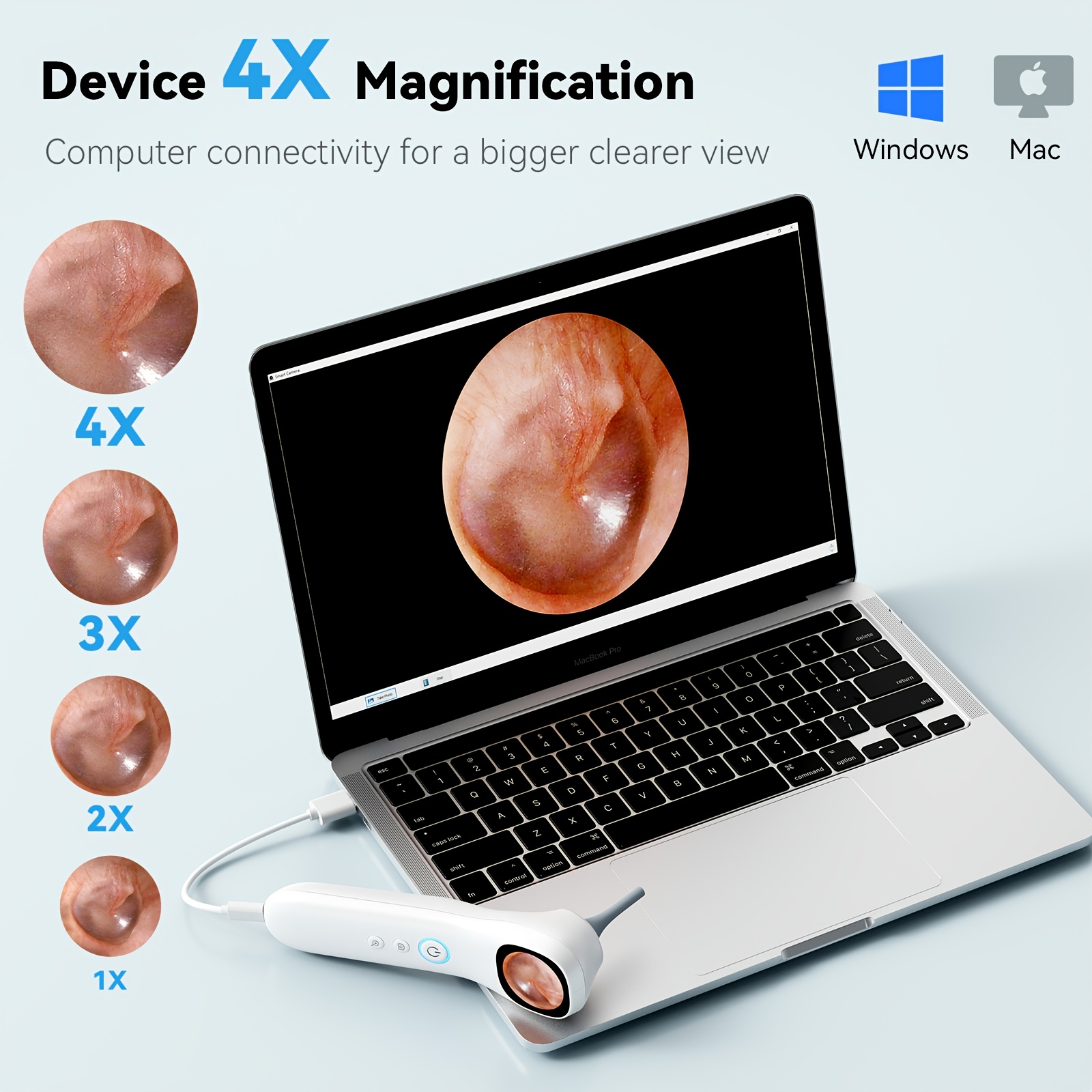 5-in-1 Ear Canal Detector with Screen & In-Ear Camera - 3-in-1 Ear, Nose, Throat/Skin Detector with 18 Interchangeable Protective Covers, Usb Rechargeable For Adults & Pets, Pet Ear Care, Ergonomic Design - Image 8