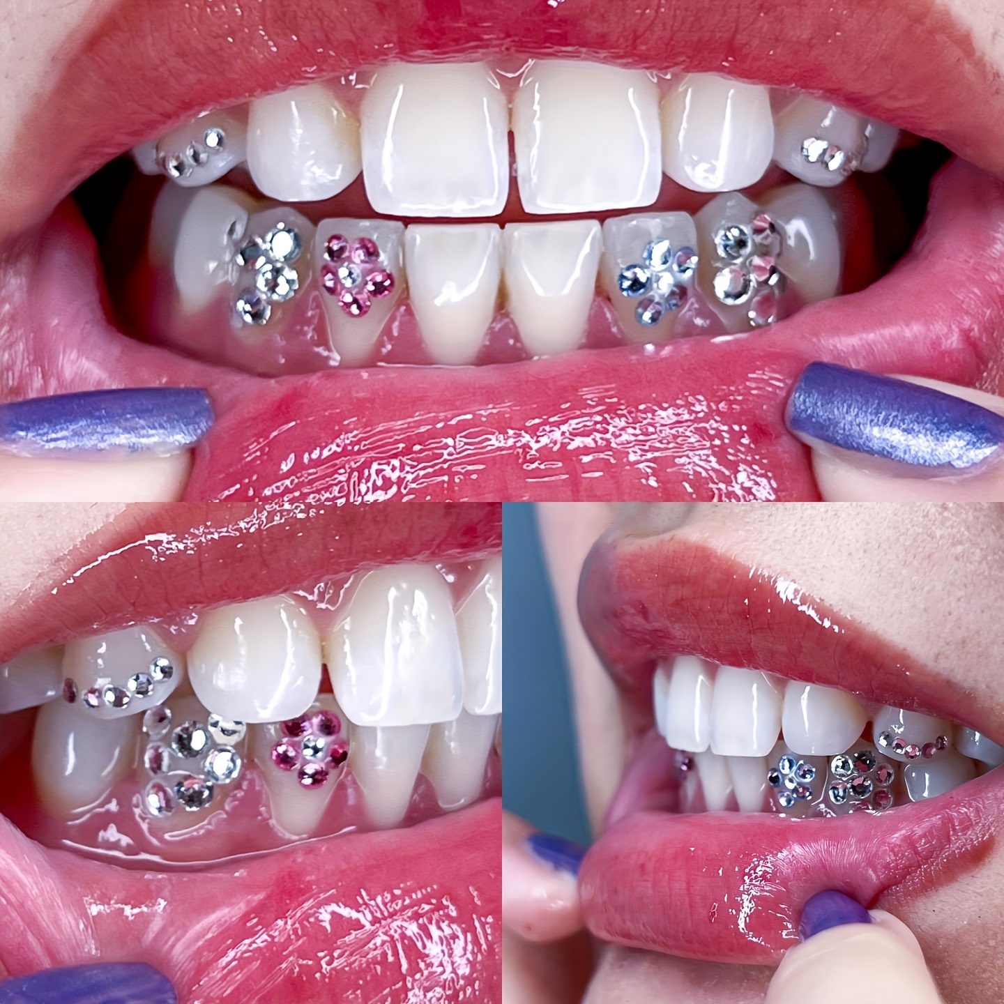 Adorno de Metal para dientes dentales, gemas dentales de varias formas,  joyería, decoración de gemas de