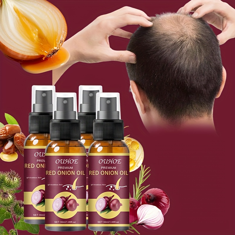 TEMU 4pcs [rosemary Hair Serum] Rosemary & Onion Hair Serum - Nourishing Scalp Massage Oil, Biotin Hair Care, Make Thin Thicker, Mother's Day Gift,