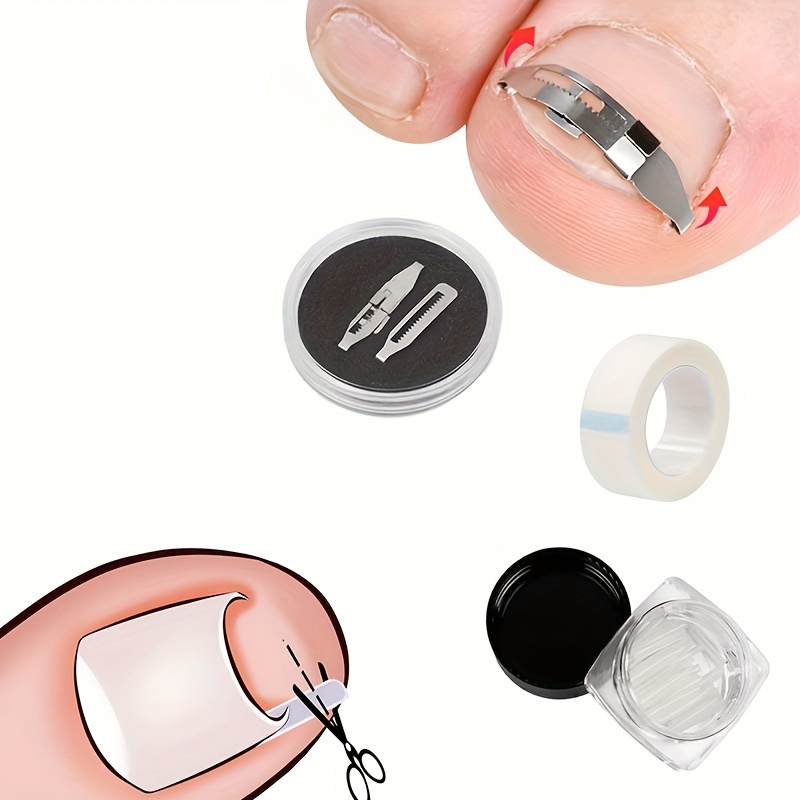 

Ingrown Toenail Treatment Kit: 3 Stretchable Correction Clips With Tape & Pads - No-scent, Adjustable Length For All Toenails