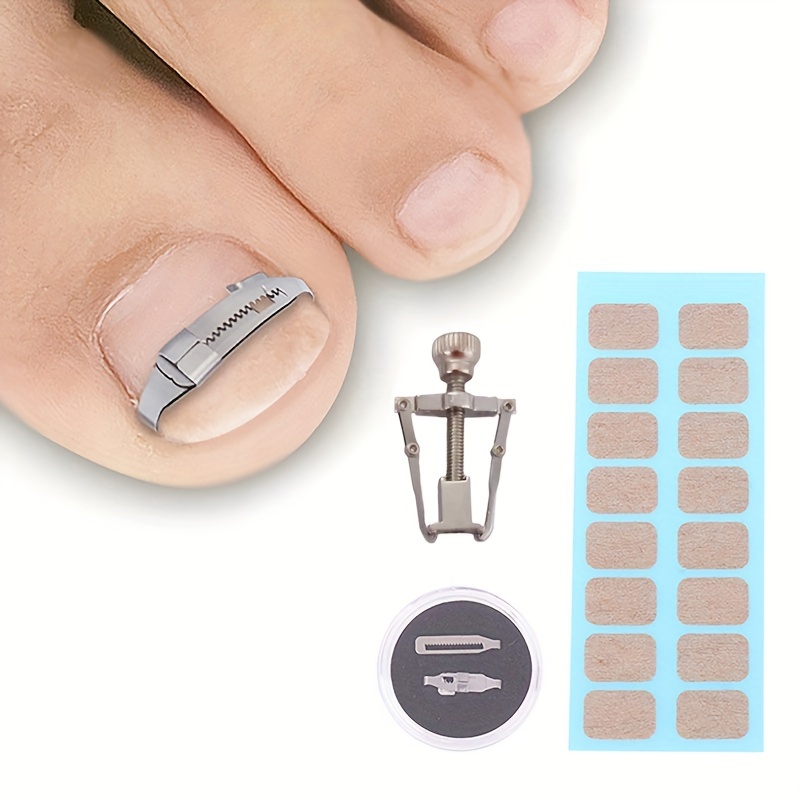 

Ingrown Toenail Treatment Set: Toenail Straightening Clips With Correction Patches, Stainless Steel Pedicure Tools, Unscented, Nail Care Kit For Toe Nail Repair And Maintenance