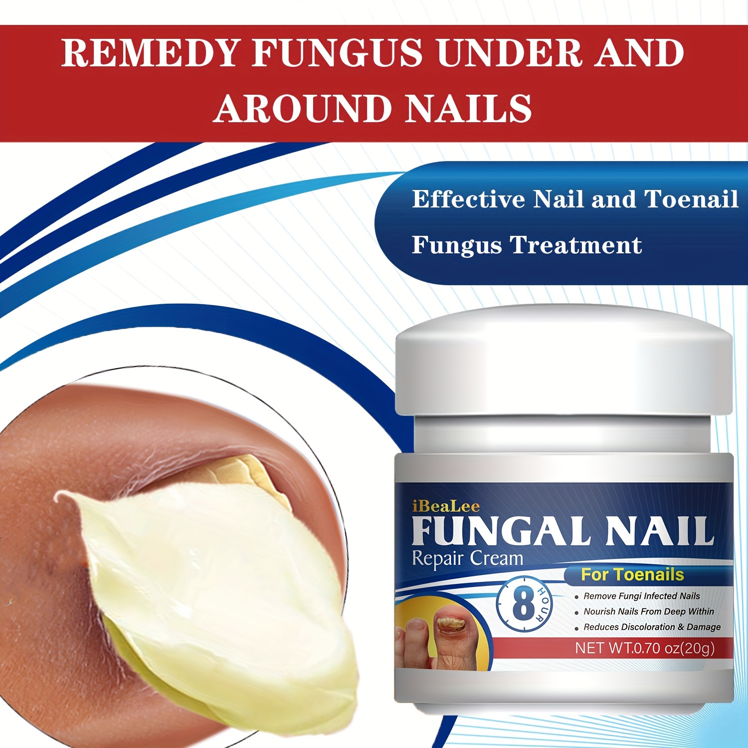 Antifungal Cream For Toenails Nails Soothing Relief From Fungus