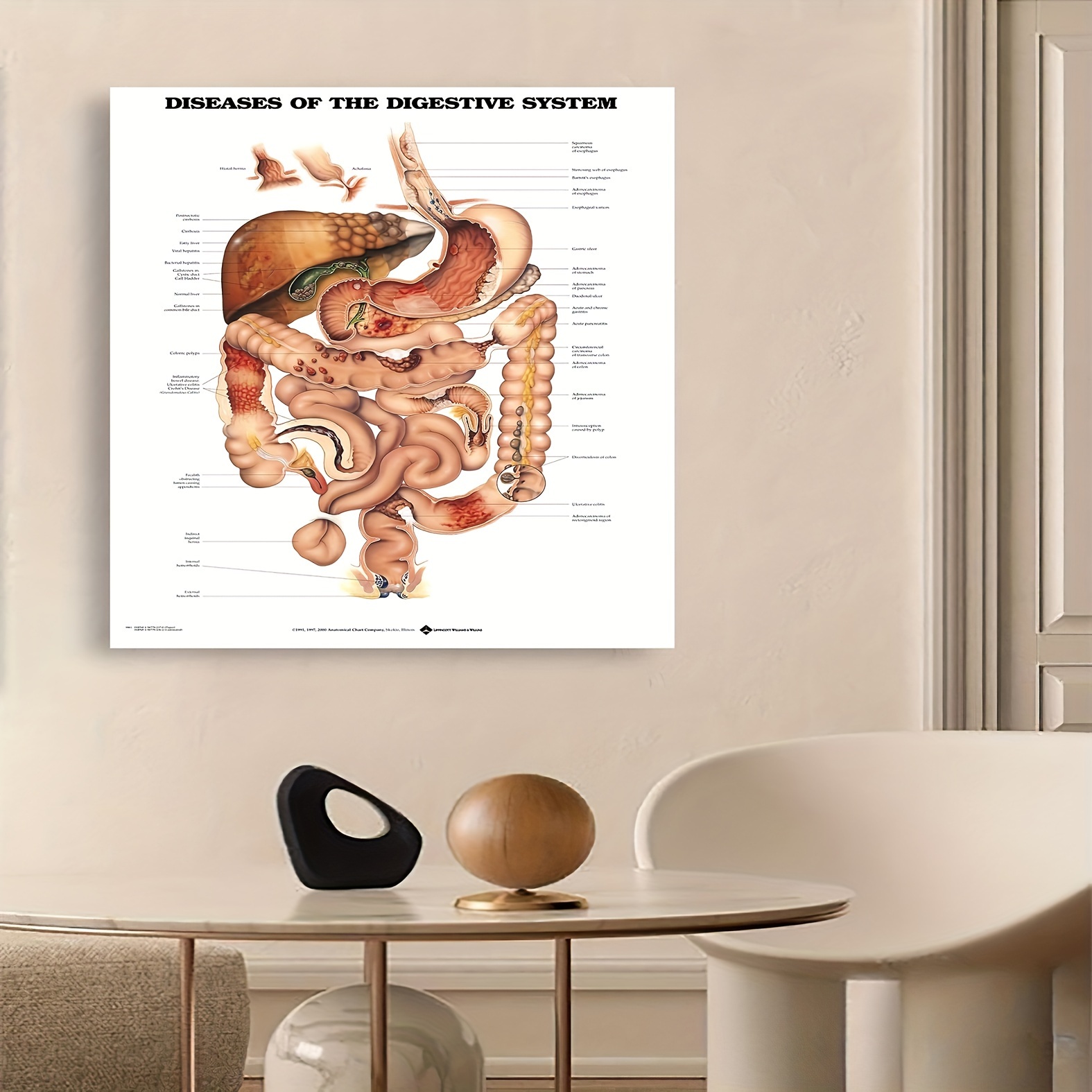 

Human Digestive System Anatomy Poster: Educational Medical Illustration For Classrooms, Halls, Or Home Decor - Framed Canvas Art