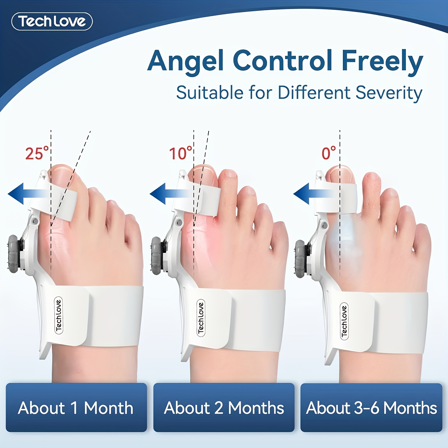   correction kit adjustable button splints toe separator and toe training band Product details 1