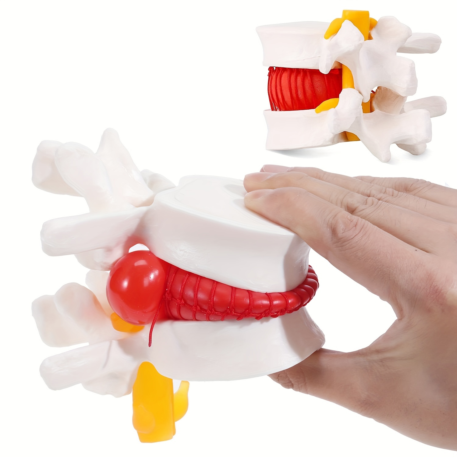 

Human Anatomical Lumbar Disc Herniation Model White- Lumbar Spine Model For Teaching & Learning - Excellent Way For Demonstrating Disc