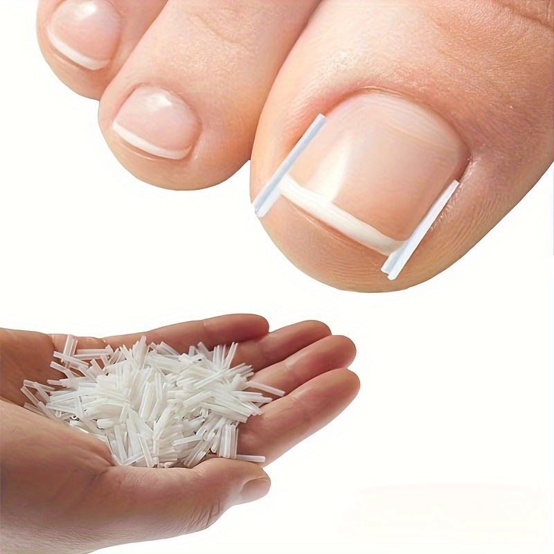 

50pcs/box, Clear Acrylic C-shaped Ingrown Toenail Pads, Nail Stickers For Toe Protection