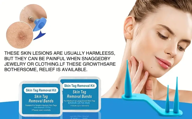 3 in 1 skin tag remover wart removal mole kit tools skin tag removal kit with fast acting and effectively easy to use at home details 4