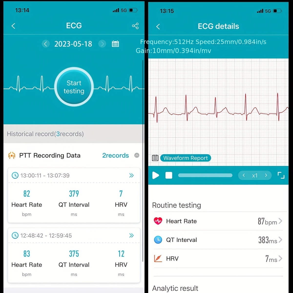 WiFi Blood Pressure Monitor with Checking Heart Rate/AI ECG Analysis  Function US