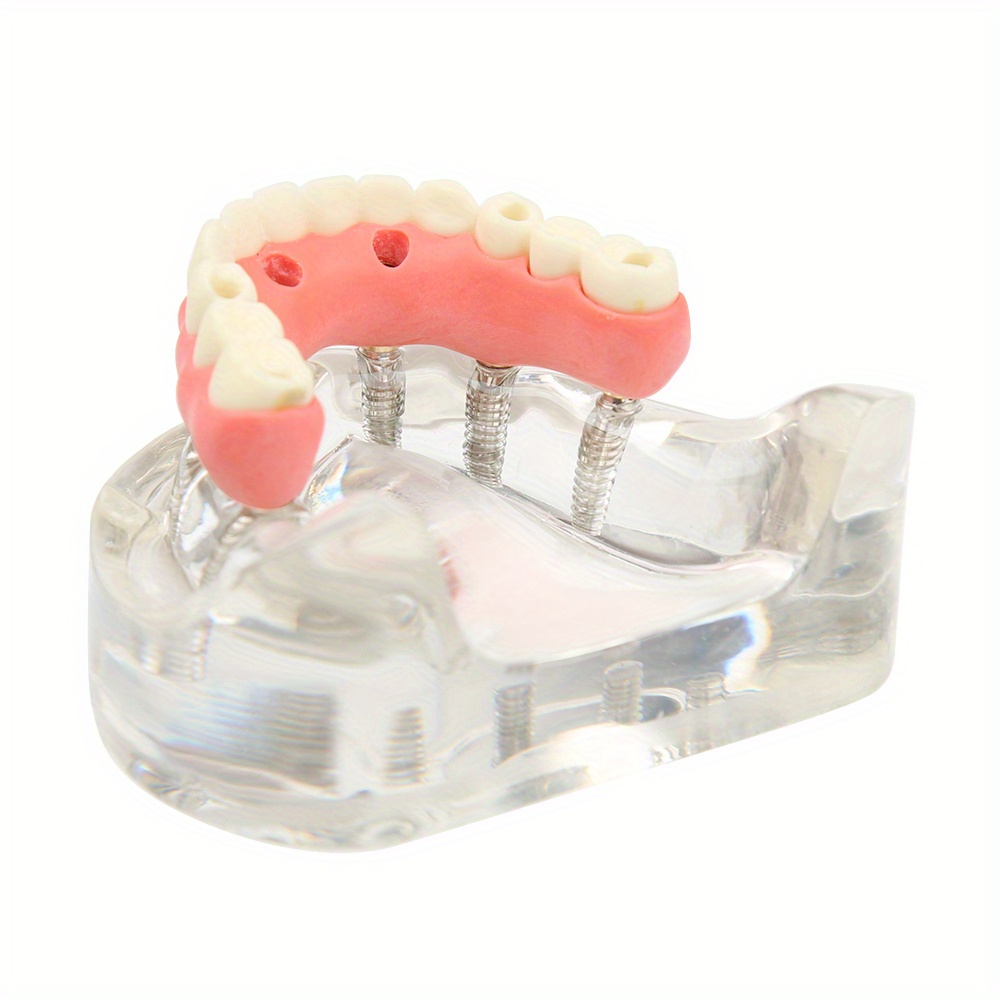 【裁断済み】2023 Dental Implantology 1-6号 セット DSI DSI Grip Ptery Surgical Kit | Discover Dental Products