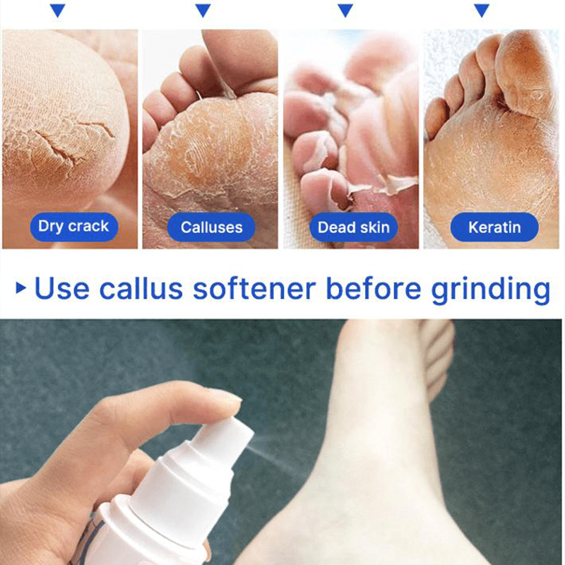 Unscented Callus Remover Gel | Extra Strength