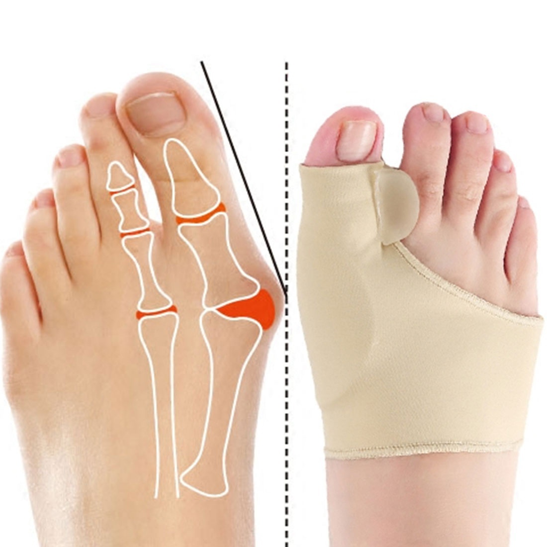 1 Pair Toe Corrector Foot Care Bone Socks Bunion Straightener