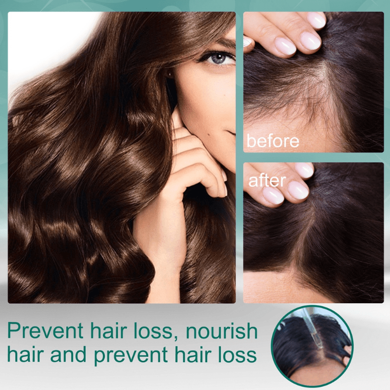 Eelhoe Hair Care Essential Oil Hair Repair Hair Follicle Care Liquid Smoothing Dry Nutritional Frizz | Free Shipping For New Users | Temu Eelhoe Hair Care Essential Oil Hair Repair Hair Follicle Care Liquid Smoothing Dry Nutritional Frizz | Free Shipping For New Users | Temu