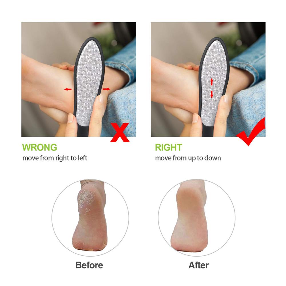 Stainless Steel Foot File Callus Remover - Professional Foot Scrubber