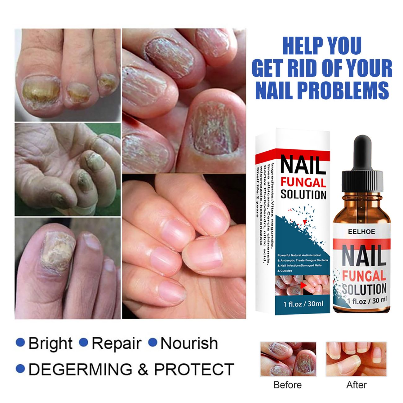 30ml Nail Repair Essence Liquid Can Nourish Hand And Foot Nails Repair And  Renew Damaged Broken Cracked And Discolored Nails Thicken Soft Nails  Strengthen Nails - Beauty & Personal Care - Temu