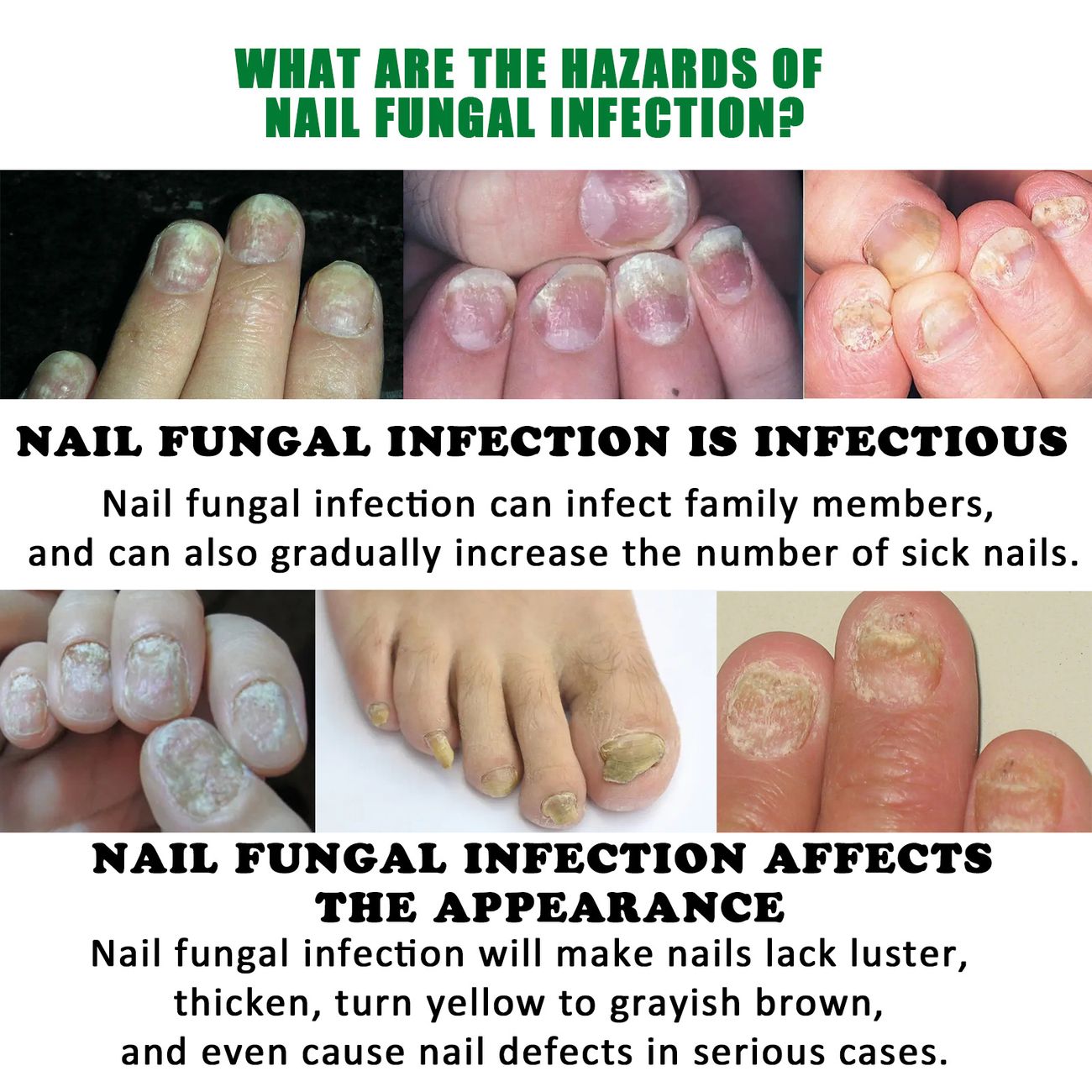 Nail Serum Nourishing Brightening Nail High Penetration No Irritation The  Nail Serum For Nail Health And Beauty 30ml | Don't Miss These Great Deals |  Temu