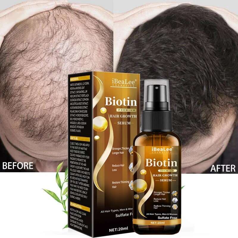 Hair Growth Products Fast Growing Hair Essential Oil Hair Care Prevent Hair  Loss Scalp Treatment For Men Women - Beauty & Personal Care - Temu
