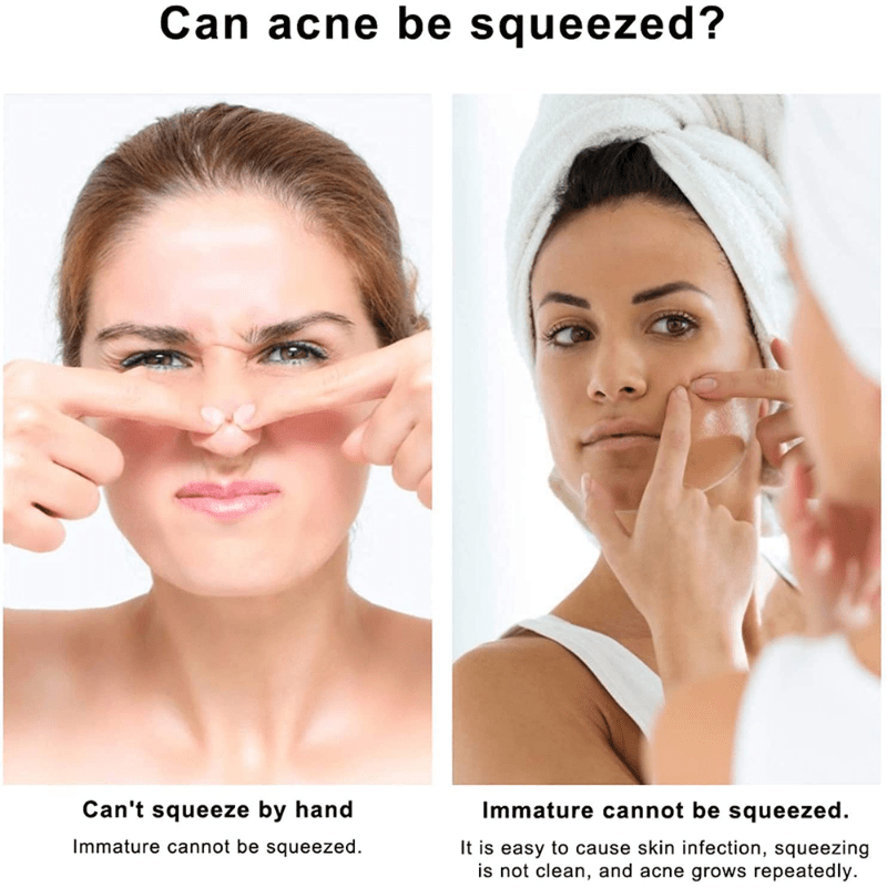 4PCS Acne Blackhead Comedone Black Spot Pimple Blemish Remover Skin Care  Women Beauty Acne Treatment Pore Cleanser Needle Hook
