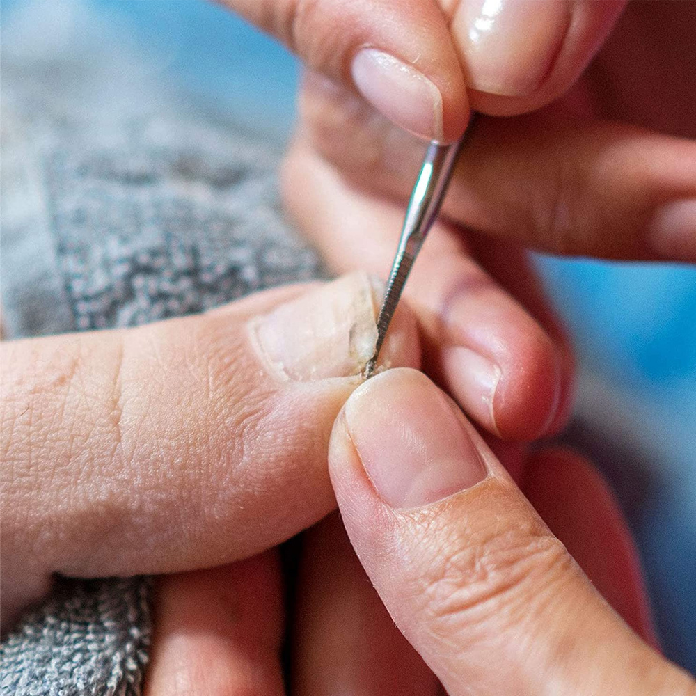 Ingrown Toenail Tools Set Ingrown Toenail Correction Patch Temu