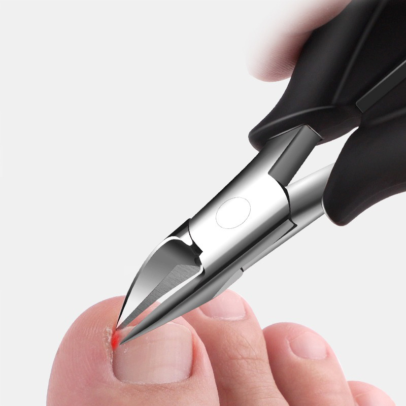 Olecranon Nail Clippers Paronychia Dead Skin Scissors Temu