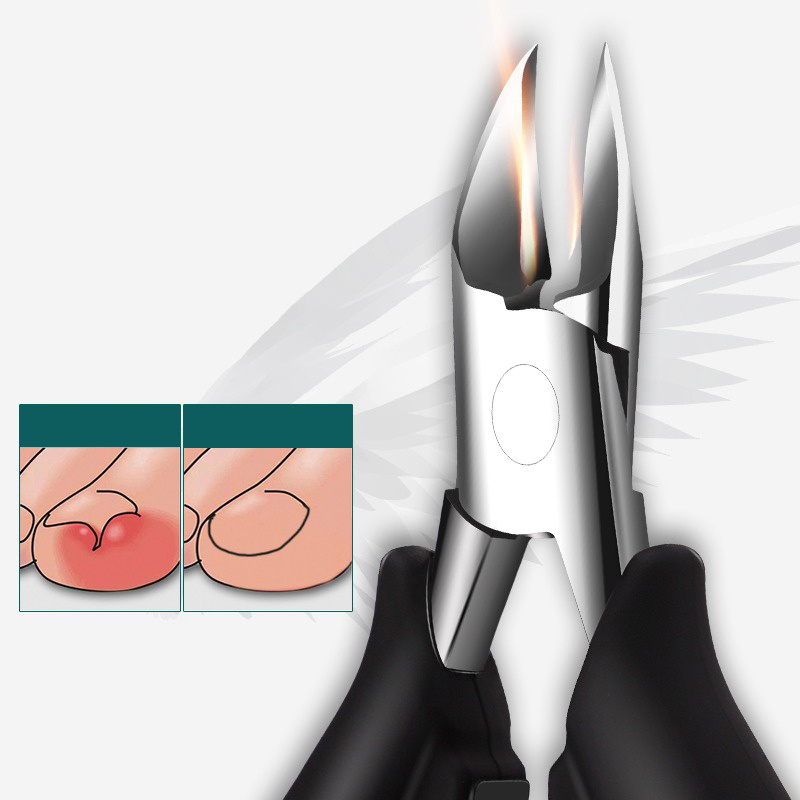 Olecranon Nail Clippers Paronychia Dead Skin Scissors Temu