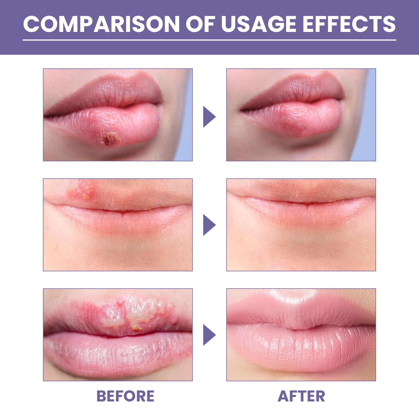 36pcs Lip Care Patch Skin Soothing Moisturizing Restorative Gentle Care Patch