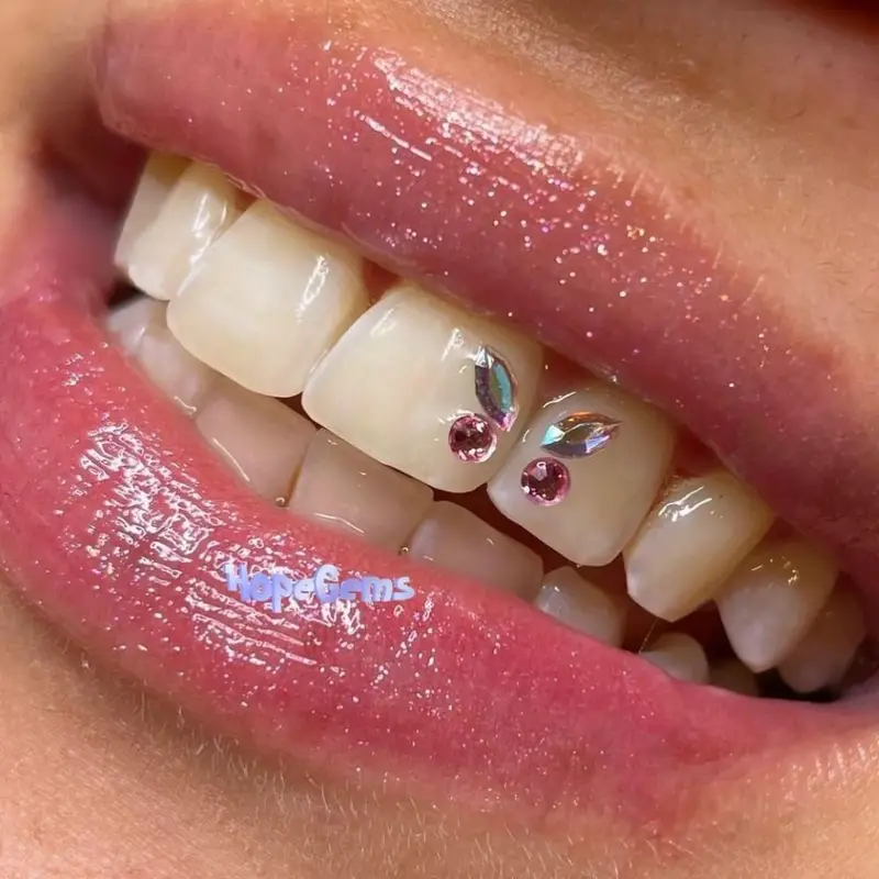 4Pcs/Box Dental Tooth Gem Kit Various Shapes Teeth Jewelry, Jewels Decoration,Temu