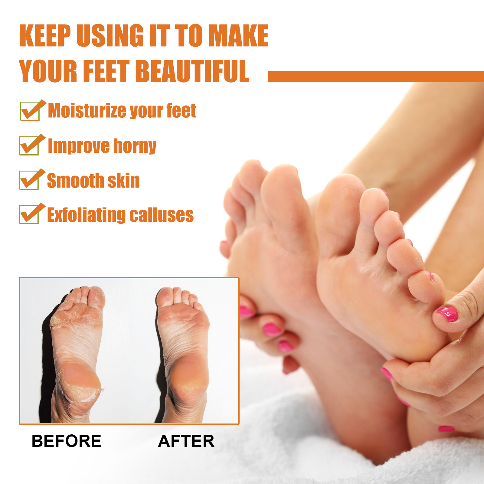 Foot Heel Callus Remover Spray,foot Callus Removal Spray,foot
