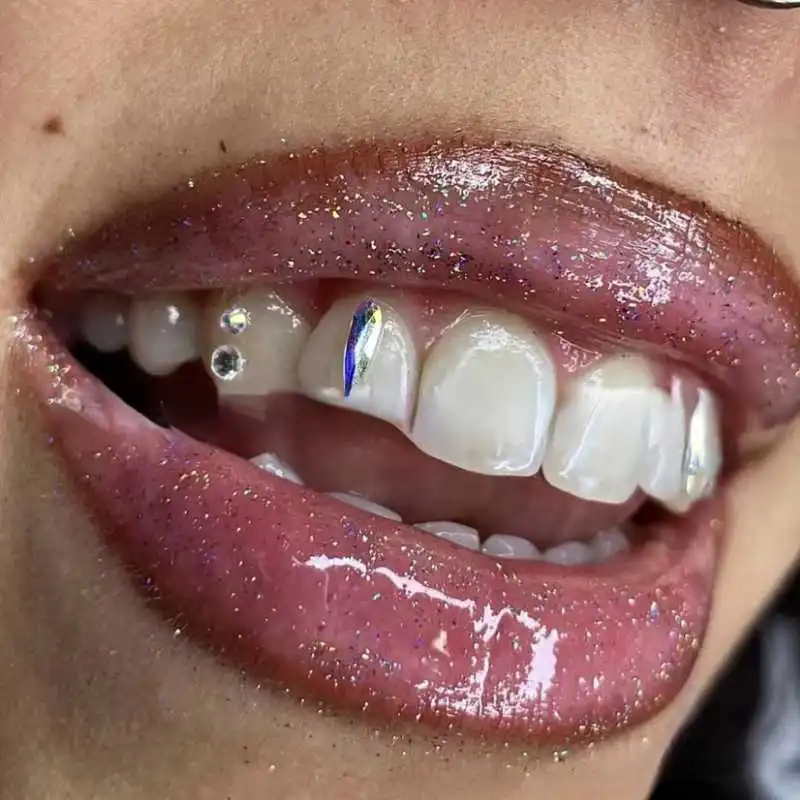 Hip Hop Dental Tooth Gems Crystal Teeth Jewelry Y2k - Temu
