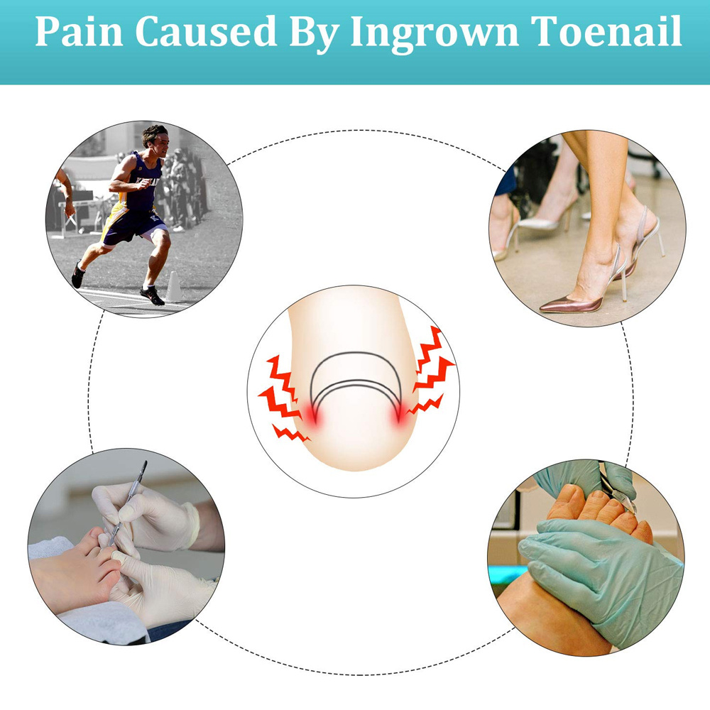 Are You Suffering from an Ingrown Toenail? - Beauchamp Foot Care