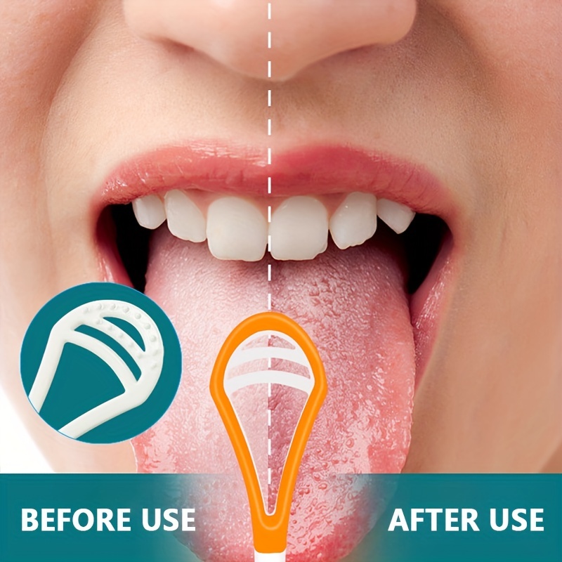 Tongue Scraper Reduce Bad Breath Oral Care Tongue Cleaners - Temu