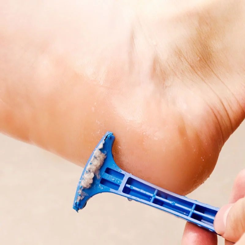

Foot Heel Callus Remover Feet Dead Skin Skin Care Tool Plastic Portable Pedicure Rasp,professional Pedicure Tool