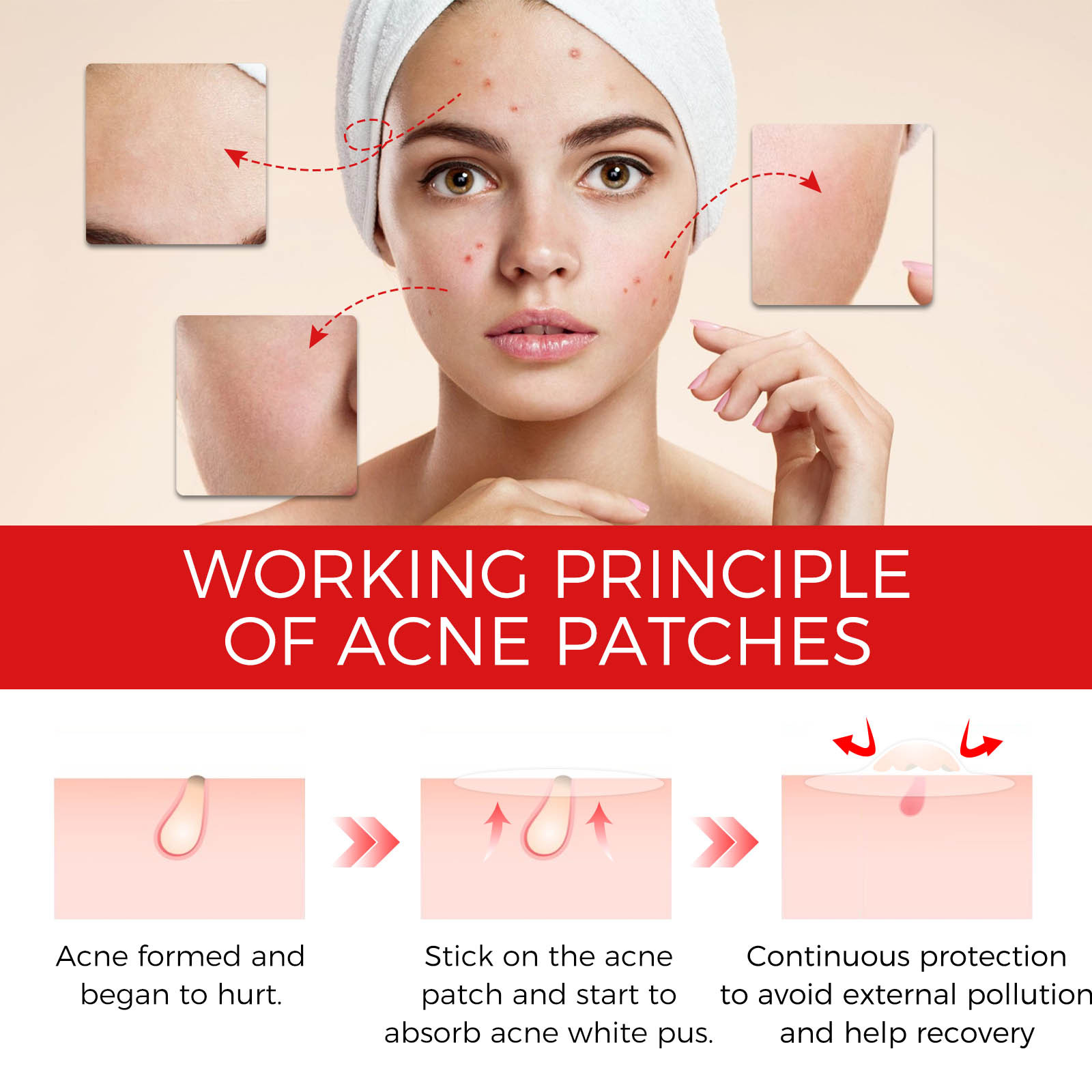 Acne Pimple Patch For Blemishes And Zits Cover, Spot Stickers For Face