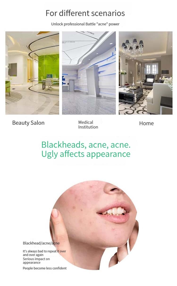 Facial Pore Cleaning Care Tools Ultra Fine Needle Tweezers Blackheads