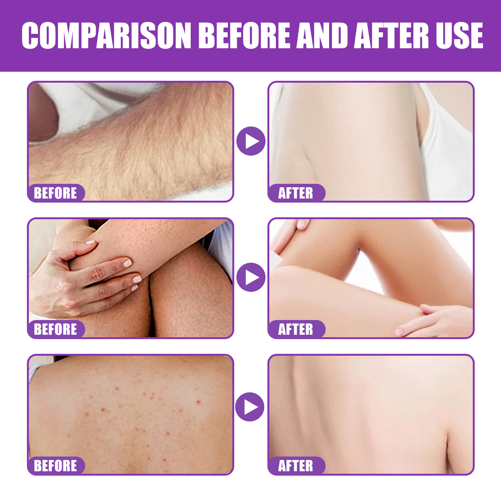 Exfoliating Body Scrub hair Removal Exfoliating Body Scrub Temu