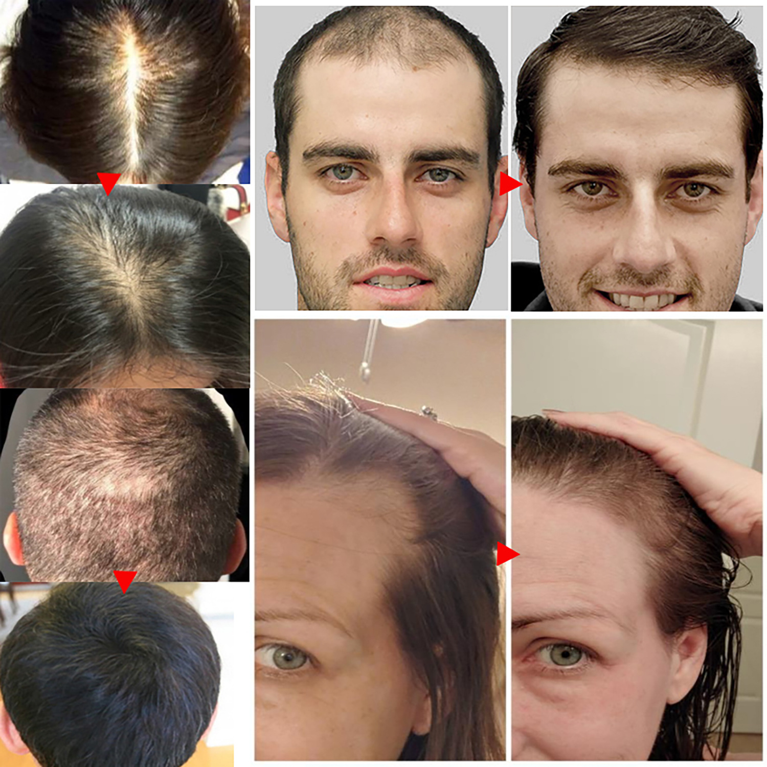 Hair Renewal Serum for Thicker Hair