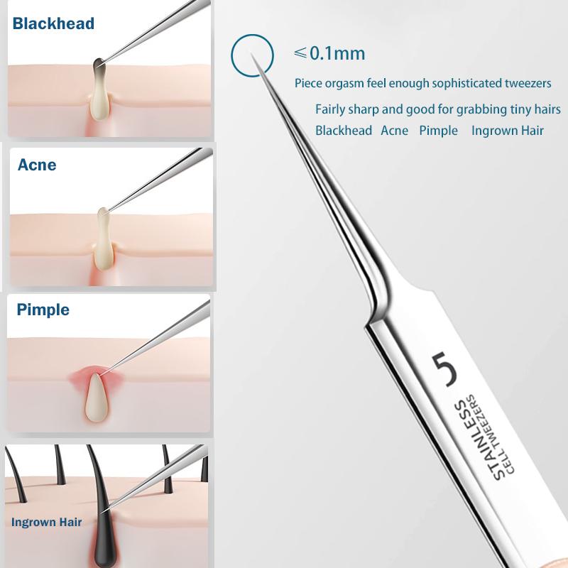11Pcs Ingrown Hair Tweezers Acne Blackhead Removal Needles Black Dots  Cleaner Pore Cleaner Deep Cleansing Face Skin Care Tools - Facial Care  Gifts For