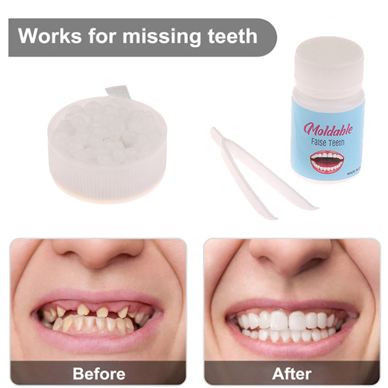 1pc 0.35oz Dientes Postizos Pegamento Sólido, Kit De Reparación De Dientes  Temporales, Dientes Y Huecos Dientes Postizos Pegamento Sólido Adhesivo Par