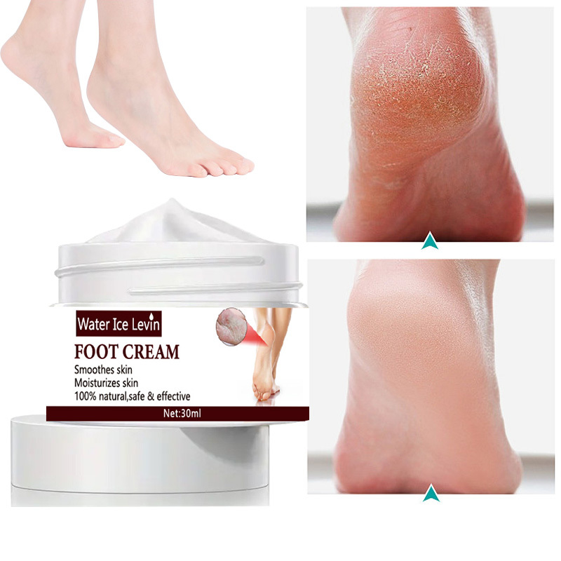 20g foot Dead Skin Remover banana oil Anti-drying crack foot cream cracked  heel repair hand