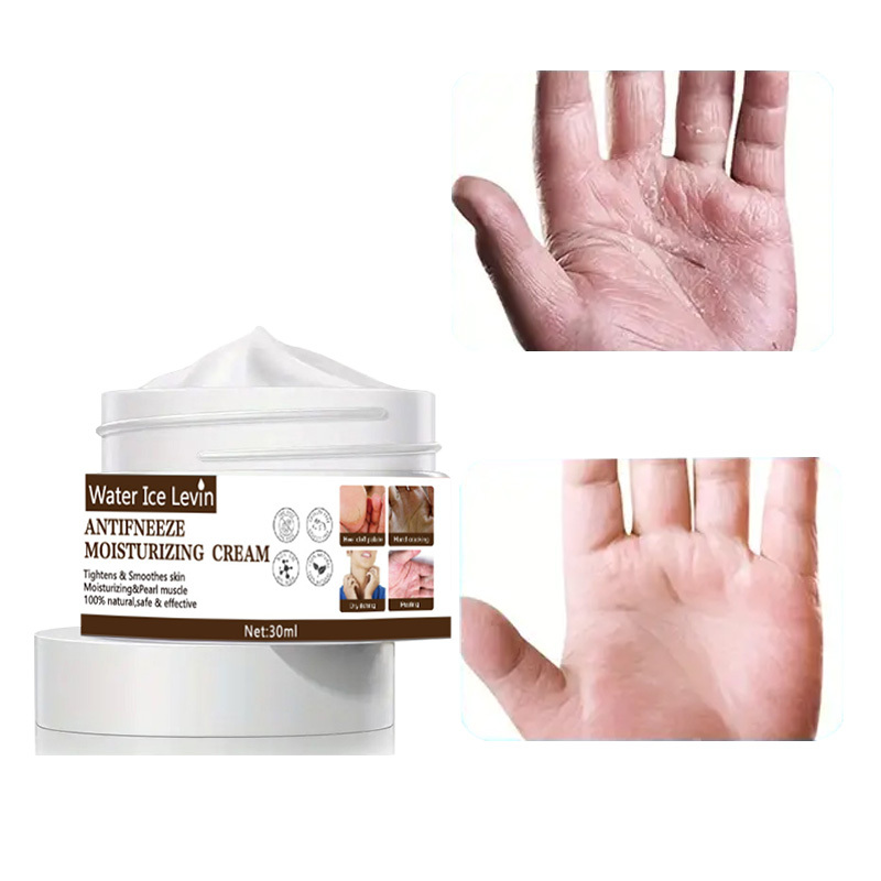 Protective Hand And Foot Hand And Foot Skin Moisturizing