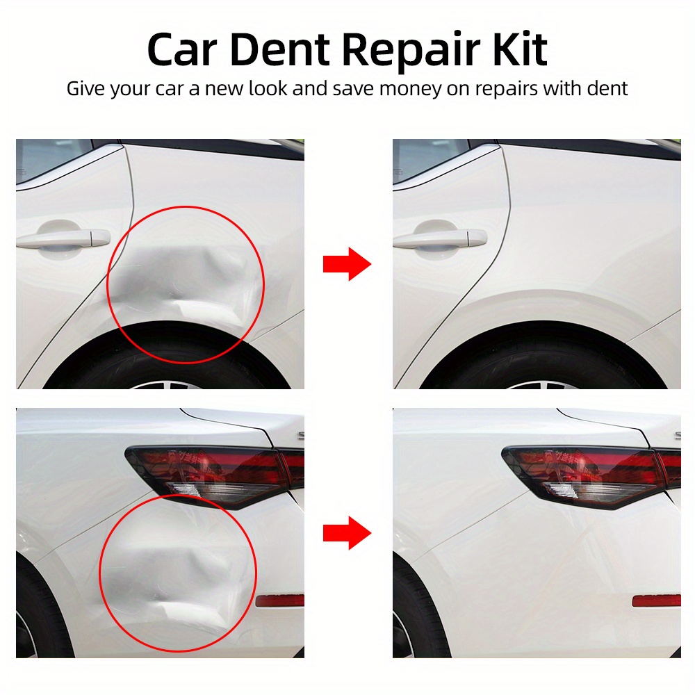 Car Dent Puller Ventose Strumenti Di Rimozione Di Ammaccature Del Corpo  Auto Ventosa Forte Kit Di Riparazione Auto