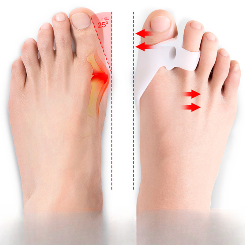 Toe Separator Silicone Corrector for Toe Correction