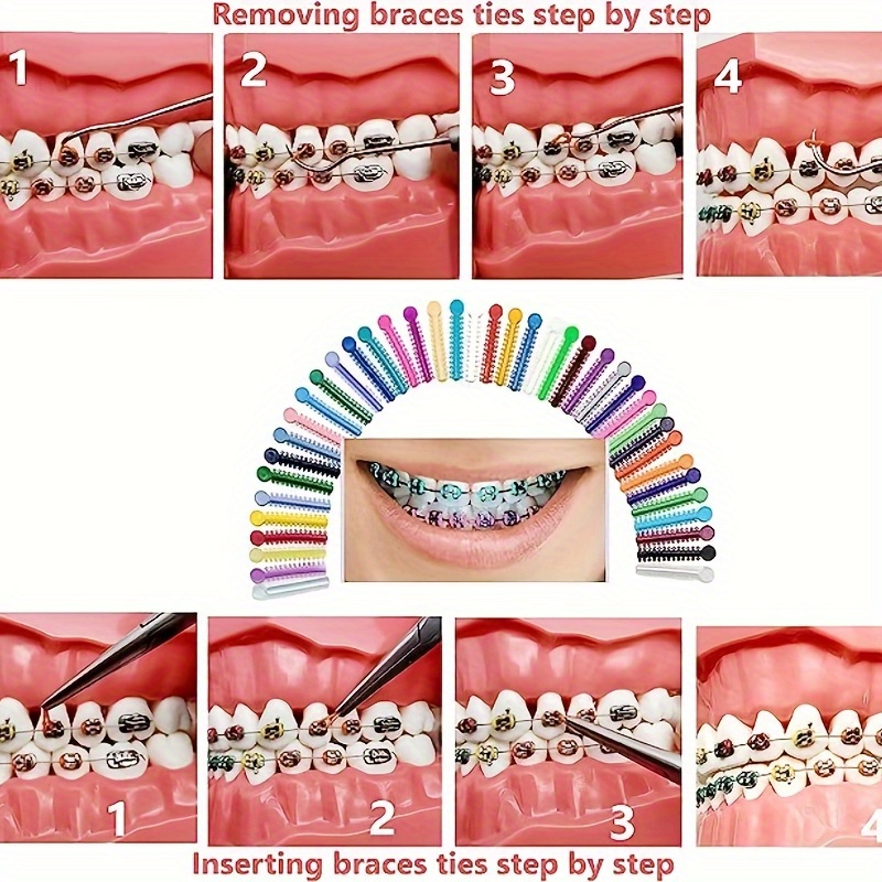 Dioche bande de caoutchouc orthodontique dentaire 40pcs bandes de caoutchouc  de ligature orthodontique dentaire multicolore - Cdiscount Au quotidien